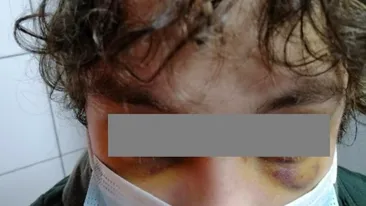 Copilărie spulberată de patima drogurilor - povestea șocantă a unui dependent de la 14 ani: a ajuns să fie snopit cu bătaia de unul din tovarăși