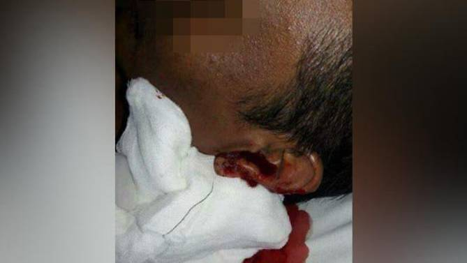 Această imagine a şocat pe toată lumea, iar gardianul a fost dus de urgenţă la spital, după ce a fost muşcat de colegul lui Gologan