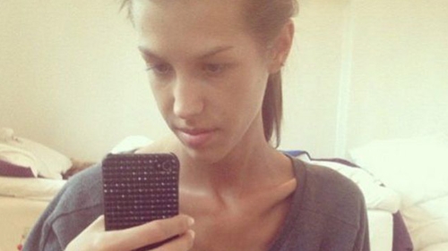 Era atat de slaba incat oamenii se speriau de ea! Cum arata dupa ce a stat doua luni in spital si s-a insanatosit