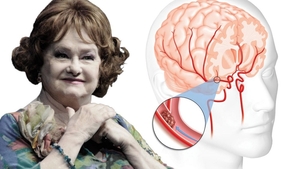 Care sunt simptomele bolii care a ucis-o pe Stela Popescu! Aceştia sunt paşii prin care le poţi recunoaşte. Află cum să te fereşti de un atac cerebral