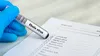 OMS avertizează că epidemia de Ebola din Congo ar putea crește. Sunt 139 de decese suspecte, iar virusul s-ar fi răspândit timp de două luni fără a fi detectat
