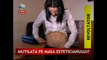 O tanara din Craiova a fost mutilata de esteticianul care trebuia sa o faca mai frumoasa! S-a ales cu abdomenul plin de cicatrici!