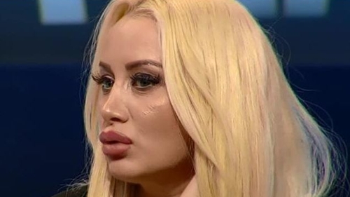 Simona Traşcă vrea să-şi opereze toată faţa: „Cu intervenţia asta lumea o să-mi dea 18-19 ani!”