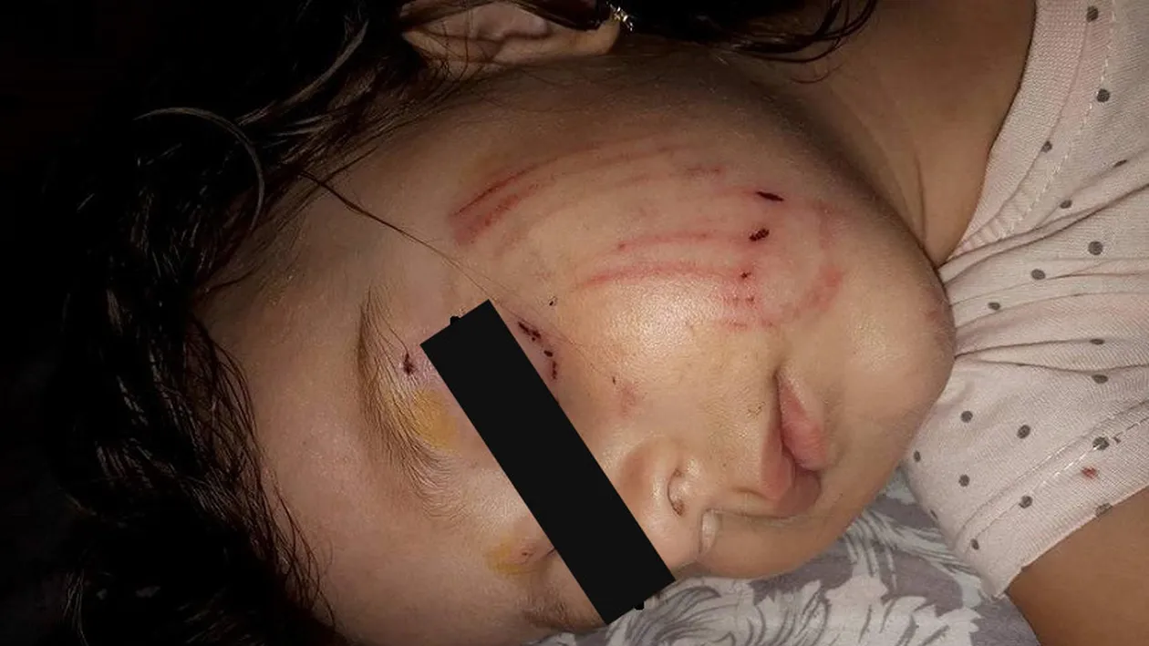 Drama unui copilaş muşcat de faţă de un câine la locul de joacă! Stăpânul animalului s-a făcut nevăzut!