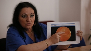 Medicul oftalmolog Monica Pop: „Am greșit! Nu sfătuiesc pe nimeni să facă așa”