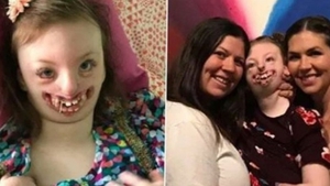 Sophia, fetița desfigurată de boala Rett și pe care unii „internauți” au batjocorit-o, a murit la vârsta de 10 ani