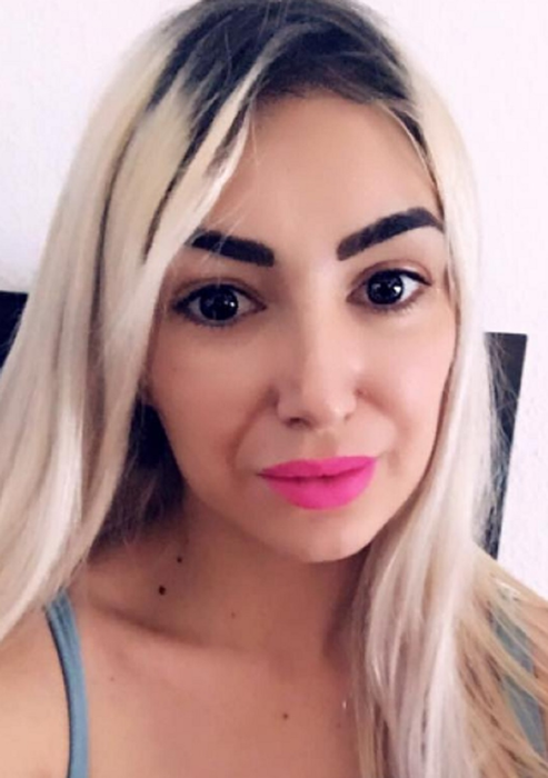 Prima imagine cu Sexy Brăileanca după ce și-a făcut intervenție estetică la nivelul feței