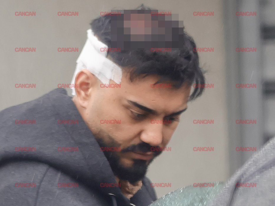 Jador a mers la cabinetul medicului pentru a-și pune implant de păr