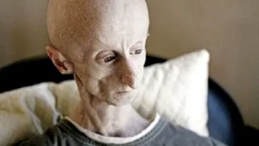 INCREDIBIL! Omul-Extraterestru traieste in Africa si are 25 de ani!