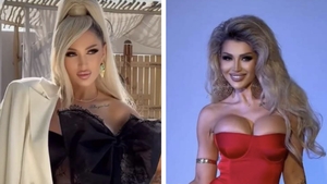 Ce presupune Morpheus, procedura estetică din cauza căreia Monalisa a murit subit la doar 35 de ani
