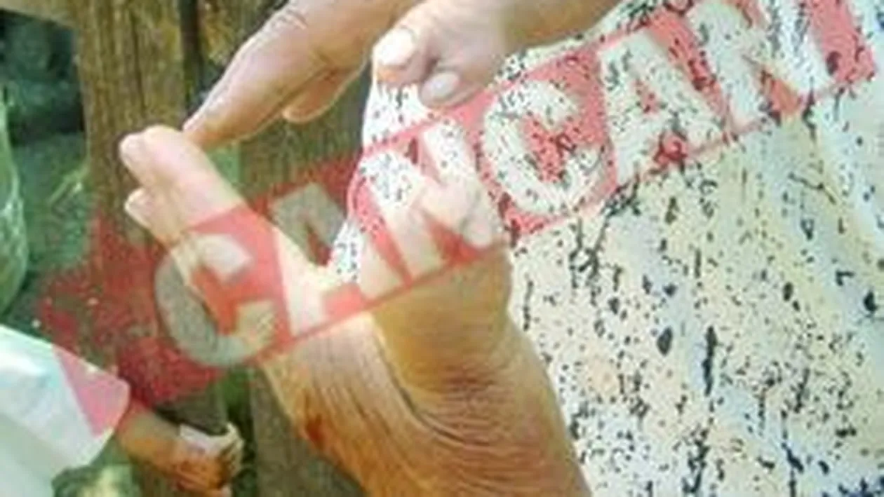 Tamaduitoarea cu 12 degete