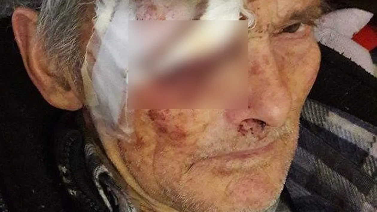 Şocant. O vâlceancă a postat pe Facebook poze cu tatăl ei, bătut crunt