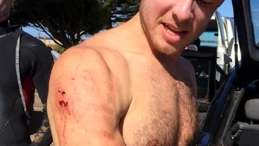 VIDEO / Un medic a bătut rechinul care a încercat să-i mănânce braţul drept: L-am lovit cât de tare am putut şi apoi...