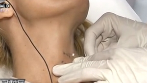 Ti se face pielea de găină! Daniela Gyorfi s-a lăsat injectată în gât in direct! "Sper să nu ajung ca Michael Jackson"