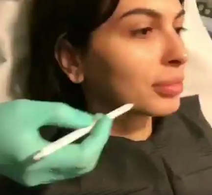 Mădălina Pamfile şi-a augmentat buzele şi şi-a modificat volumetria facială