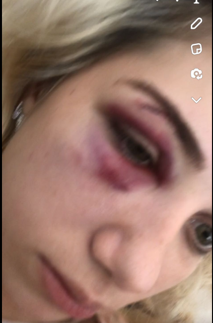 În urmă cu cinci ani, Dani ar fi agresat-o fără milă pe iubita sa, Maria.