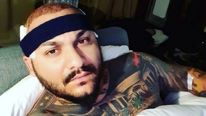 Cum arată Dani Mocanu cu păr, după ce și-a făcut implant! E de nerecunoscut