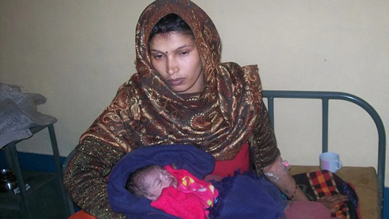 Un bebelus i-a uimit pe doctori cand au vazut cum s-a nascut! Boala care afecteaza 8 copii dintr-un milion