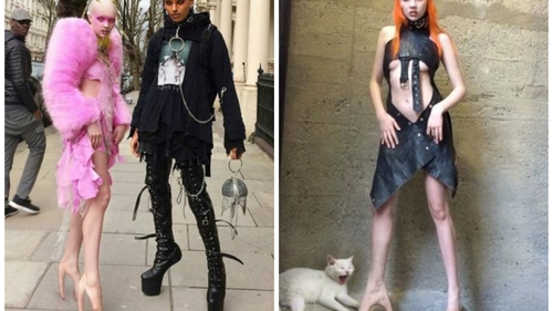 ‘Materie Fecala’, cuplul de pe Instagram care s-a viralizat imediat! Tinerii care arata ca extraterestrii sunt uluitori. De ce talpile ei arata ASA