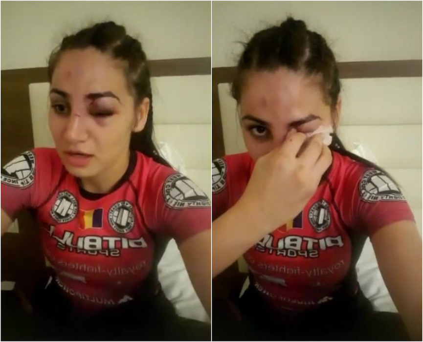 Panică! Diana Belbiță, cu ochiul vânăt și răni pe față! Imagini cutremurătoare cu „Prințesa Războinică” de la „Exatlon”