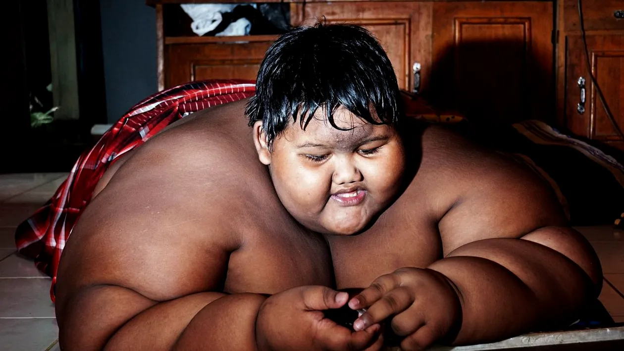 Transformare spectaculoasă! Arya Permana, poreclit „cel mai gras copil din lume”, a slăbit peste 100 de kilograme. Cum arată acum băiatul