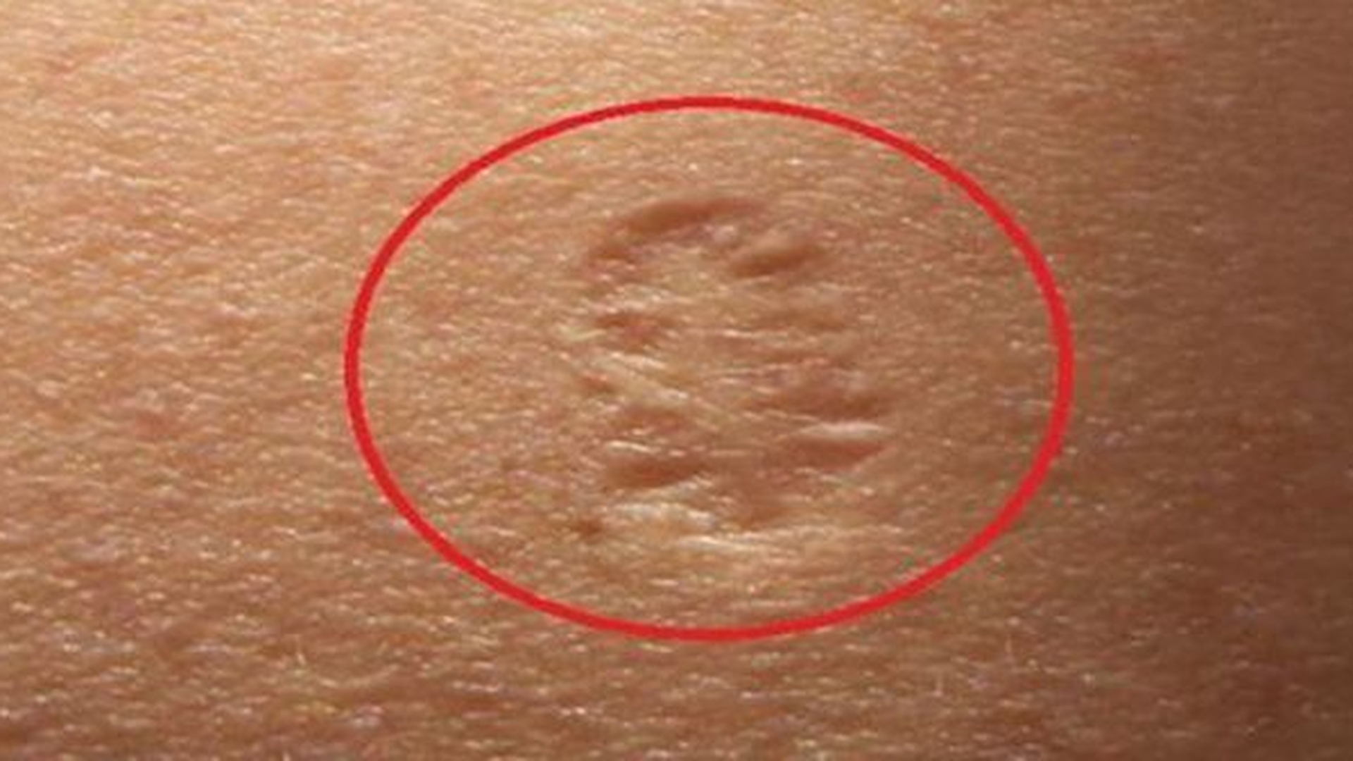 Ai si tu acest semn pe braţ? Asta este adevărata semnificaţie! Cei mai mulţi s-au căpătuit cu el înainte de ...