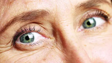 Laserul este cea mai eficienta metoda de refacere a pielii ridate