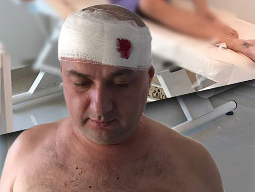 Leo a fost bătut de mai mulţi indivizi la sfârşitul lunii trecute