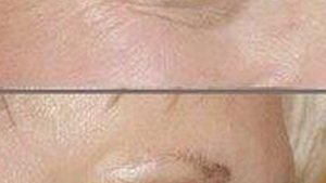 Doamnelor, exista o crema de ochi care va intinereste cu un an in doar doua minute!