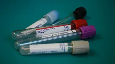 O formă nouă de hepatită face ravagii printre copii. Boala a ajuns deja și în România