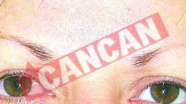 Tatuajele medicale, la concurenta cu cele traditionale