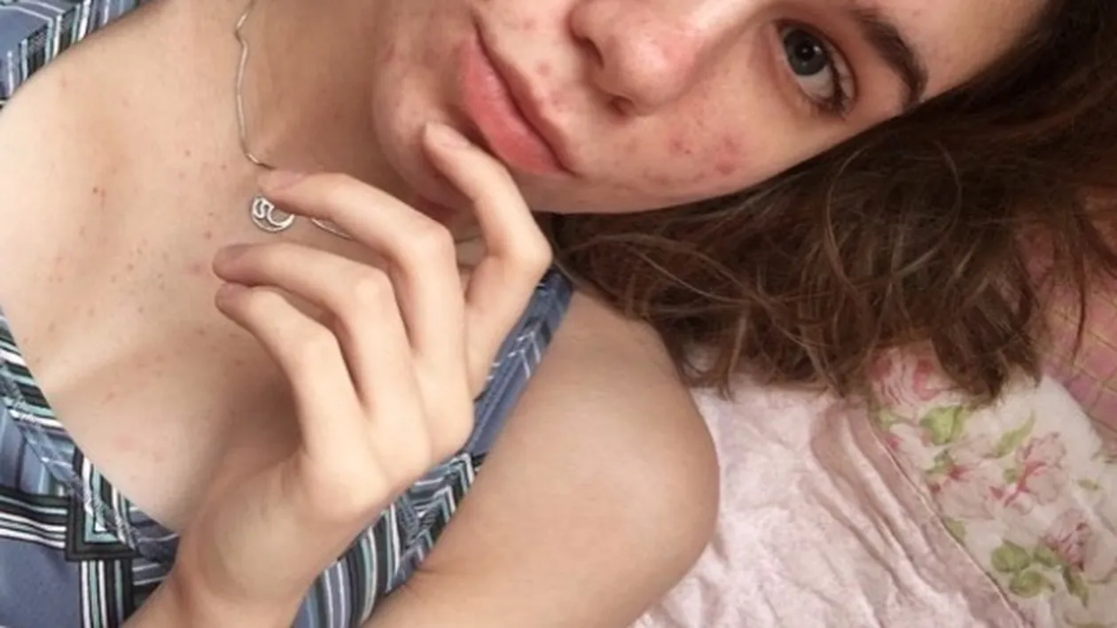 ”Când am ajuns în spital, mi s-a spus că mai am o zi până să orbesc” | Ce pastile luase de fapt fata! Atenție, ți se poate întâmpla și ție!