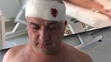 LEO de la Strehaia, apel disperat după ce a fost măcelărit în stradă:,,Vă rog... ‘’