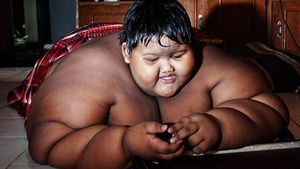 Transformare spectaculoasă! Arya Permana, poreclit „cel mai gras copil din lume”, a slăbit peste 100 de kilograme. Cum arată acum băiatul
