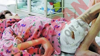 Fratele fetitei de 15 ani si 13 kilograme: "Gabriela a fost alimentata tot timpul"