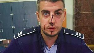 Poliţist cu nasul spart, după ce a primit un cap în faţă de la un şofer beat. S-a întâmplat în Dolj