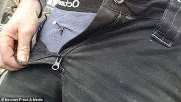 Un cui i-a străpuns zona pelviană! Ce au descoperit medicii când i-au dat jos hainele