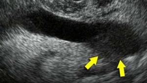 Verdict cutremurator: Un sportiv urias are CANCER si va fi operat de urgenta! Anuntul care a speriat o lume intreaga
