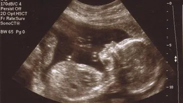 Bebelus nascut fara picioare. Mama spune ca a facut ecografii si i s-a spus ca nu sunt probleme