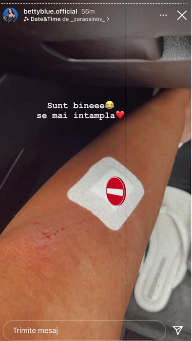 Betty Salam s-a accidentat pe plajă! ”O să-mi rămână semn”