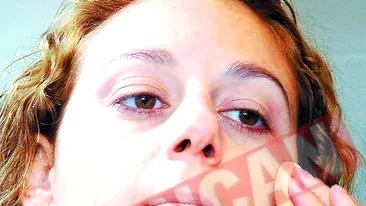 Sfaturi de ingrijire a pielii iarna