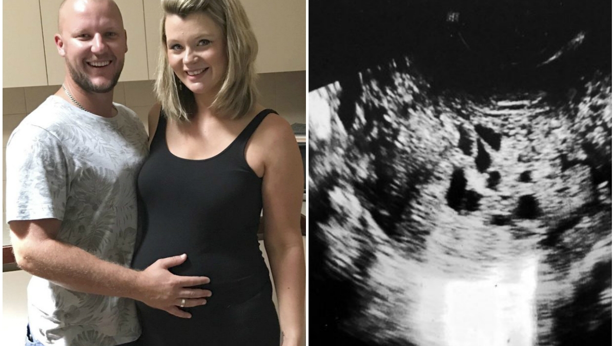 Se pregatea sa nasca si era in culmea fericirii! Aceasta mamica a descoperit insa un adevar socant cand a mers la spital. Ce a adus de fapt pe lume