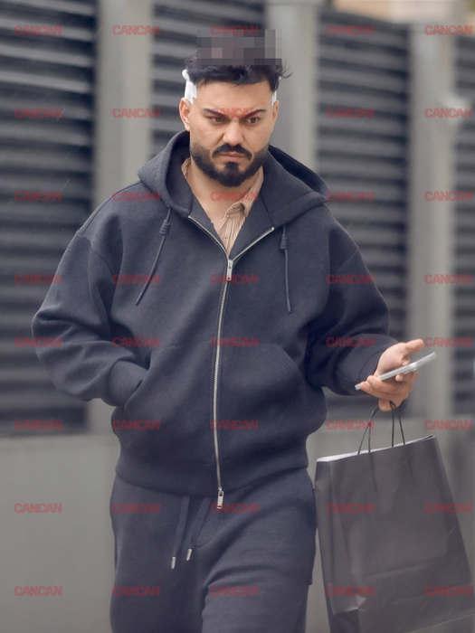 Jador și-a făcut implant de păr