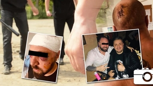 Poliția este în alertă. Un interlop celebru a fost mutilat în bătaie de ”Garda de Fier”