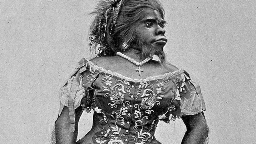 Cine era Julia Pastrana? Anomalia genetică extrem de rară care o făcea pe această femeie să arate ca un…urangutan