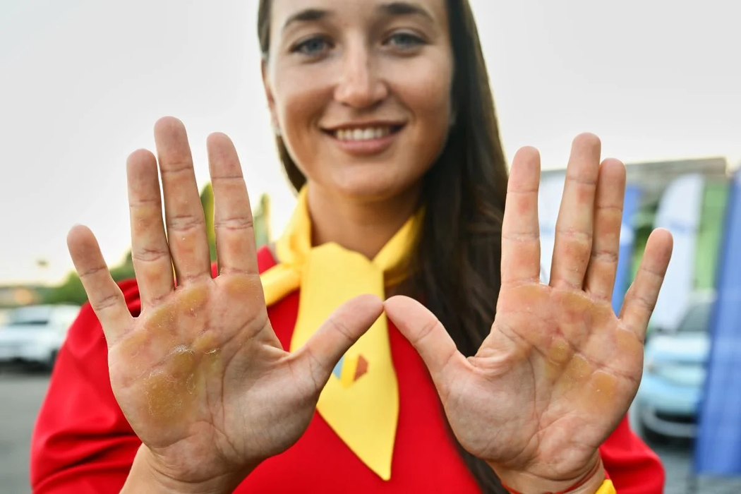 Imagini greu de digerat. Cum arată palmele canotorilor de la JO 2024. Ai curaj să le vezi?