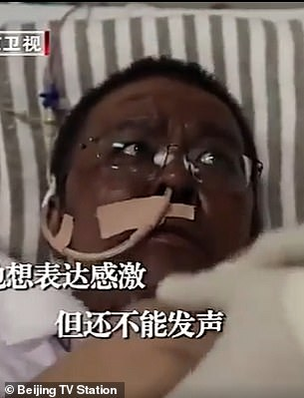 Doi medici infectați cu COVID-19 s-au trezit cu pielea neagră. Cum a fost acest lucru posibil. Foto incredibil