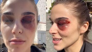 Apariție terifiantă a lui Theo Rose! Artista s-a filmat cu un ochi vânăt: „Cum am ajuns în situația asta?”