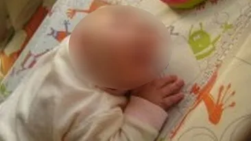 A fumat, a baut si a prizat cocaina in timpul sarcinii! Medicii au fost SOCATI cand au vazut cum arata bebelusul