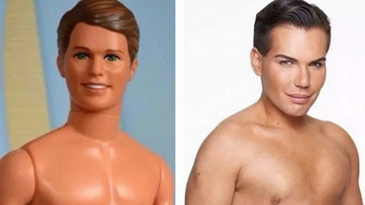 A spart 150.000 de dolari pe operatii estetice pentru a arata precum Ken! A fost la un pas de moarte: Am vrut sa imi tai bratul